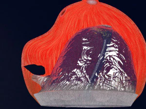 Retinal detachment types eye 3D Model