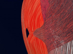 Retinal detachment types eye Modelo 3D