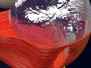 Retinal detachment types eye Modelo 3D