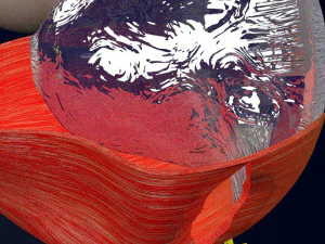 Retinal detachment types eye 3D Model