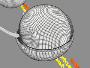 Retinal detachment types eye 3D Model
