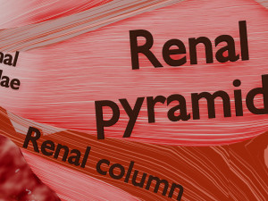 Renal cell carcinoma Modelo 3D