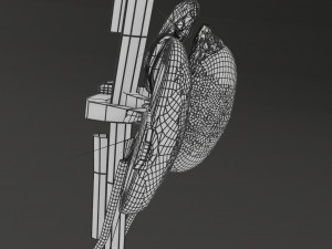 Renal cell carcinoma Modelo 3D