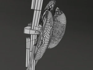 Renal cell carcinoma 3D Model