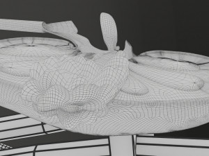Renal cell carcinoma Modelo 3D