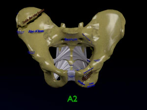 Fraturas da pelve Modelo 3D
