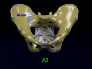 Fraturas da pelve Modelo 3D