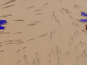 Mole nevus cancer Malignant melanoma differences 3D 3D Model