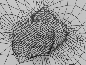 Mole nevus cancer Malignant melanoma differences 3D Model 3D