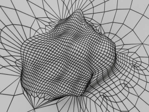 Mole nevus cancer Malignant melanoma differences 3D 3D Model
