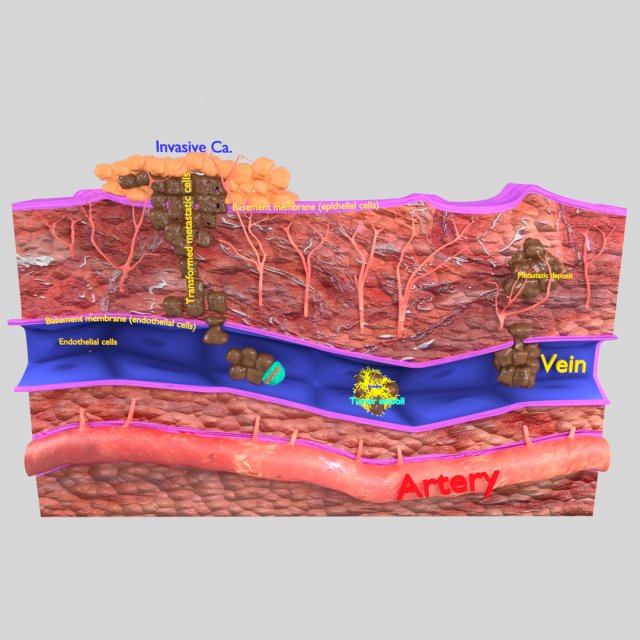 3D cancer metastasis spread model Modelo 3D .c4d .max .obj .3ds .fbx .stl .blend 