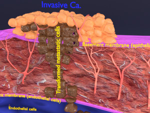 3D cancer metastasis spread model Modelo 3D