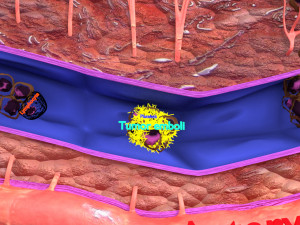 3D cancer metastasis spread model Modelo 3D