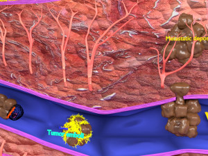 3D cancer metastasis spread model Modelo 3D