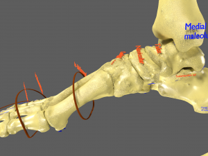 Limbs With Girdle bones name parts text labelled 3D 模型