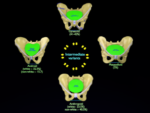 Pelvis types hip bone labelled detailed 3Dモデル