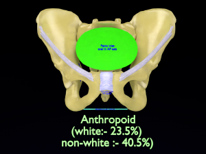 Pelvis types hip bone labelled detailed 3Dモデル