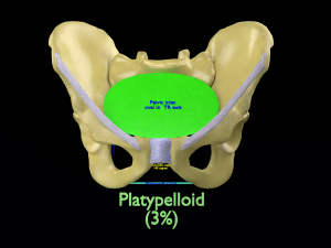 Pelvis types hip bone labelled detailed 3Dモデル