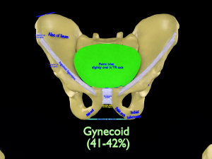 Pelvis types hip bone labelled detailed 3Dモデル