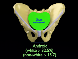 Pelvis types hip bone labelled detailed 3Dモデル