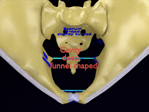 Pelvis types hip bone labelled detailed 3Dモデル