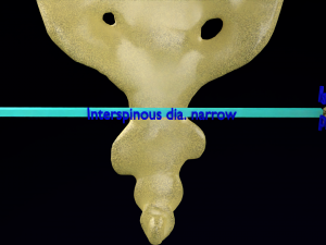Pelvis types hip bone labelled detailed 3Dモデル