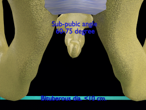 Pelvis types hip bone labelled detailed 3Dモデル