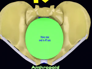 Pelvis types hip bone labelled detailed 3D Model
