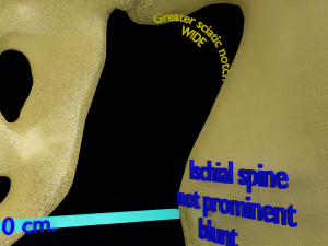 Pelvis types hip bone labelled detailed 3Dモデル