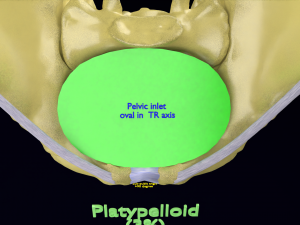Pelvis types hip bone labelled detailed 3Dモデル