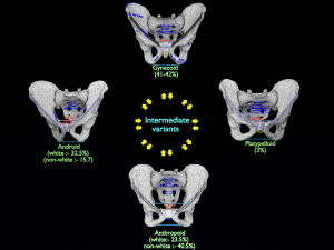 Pelvis types hip bone labelled detailed 3Dモデル