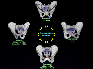 Pelvis types hip bone labelled detailed 3D Model