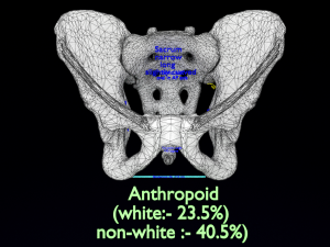 Pelvis types hip bone labelled detailed 3Dモデル