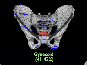 Pelvis types hip bone labelled detailed 3Dモデル