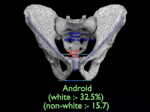 Pelvis types hip bone labelled detailed 3Dモデル