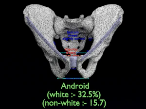 Pelvis types hip bone labelled detailed 3D Model
