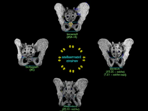 Pelvis types hip bone labelled detailed 3D Model