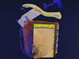 Breast Cancer types spread labelled detail 3D Model