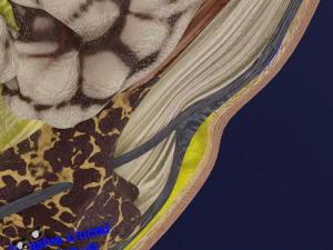 Breast Cancer types spread labelled detail 3D Model