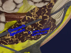 Breast Cancer types spread labelled detail 3D Model