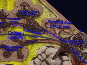 Breast Cancer types spread labelled detail Modelo 3D