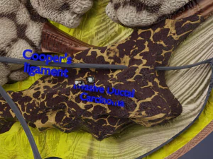 Breast Cancer types spread labelled detail 3D Model