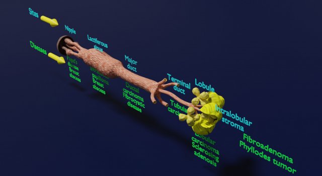 Breast duct sites and diseases 3D Модель .c4d .max .obj .3ds .fbx .stl .blend 