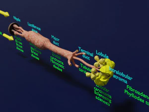Breast duct sites and diseases 3D Model