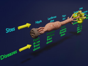 Breast duct sites and diseases 3D Модель