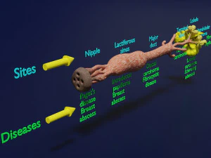 Breast duct sites and diseases 3D Model