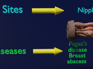 Breast duct sites and diseases 3D Модель