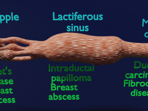 Breast duct sites and diseases 3D Модель