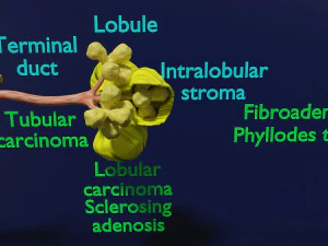 Breast duct sites and diseases 3D Model