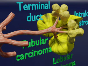 Breast duct sites and diseases 3D Model